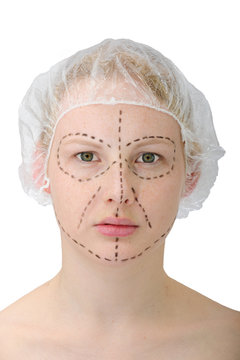 woman&acute;s face before plastic surgery, face lift