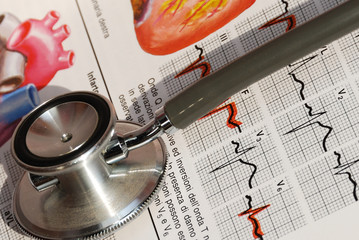 Fonendoscopio