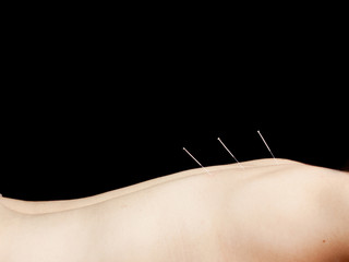 Acupuncture points on a ladies back