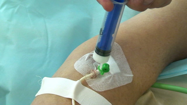 Propofol Injection In Operation Room