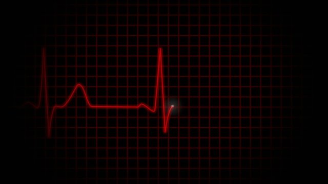 Ekg heart beat with heart
