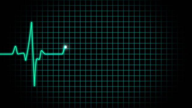 Ekg heart beat
