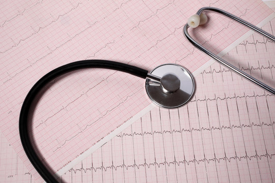 stetoscopio poggiato su elettrocardiogramma