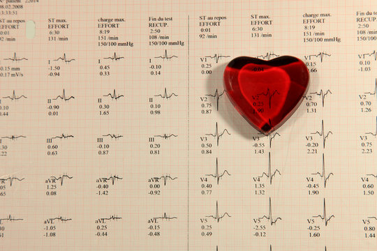 coeur et electrocardiogramme