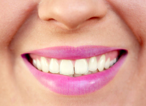 Closeup of smiling young woman mouth teeth