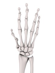 Handskelett mit athritischen Fingern