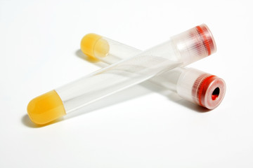test tubes