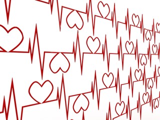 Cardiogram