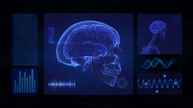 Medical display in loop - human brain concept