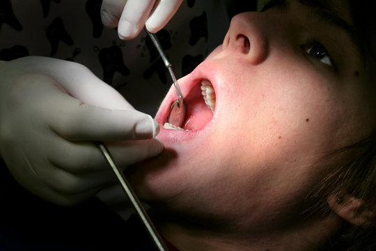 Jugendlicher beim Zahnarzt