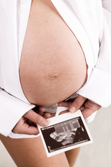 Young pregnant woman holding an ultrasonic test print
