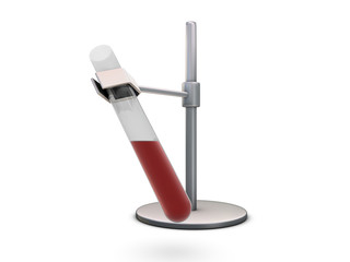 Test-tube with blood