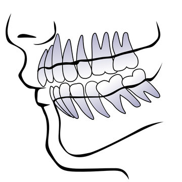 dentatura