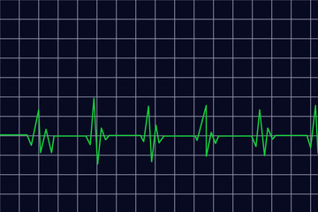 diagramm - herzfrequenz