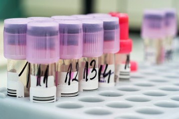 test tubes