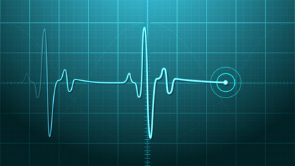 EKG - Electrocardiogram