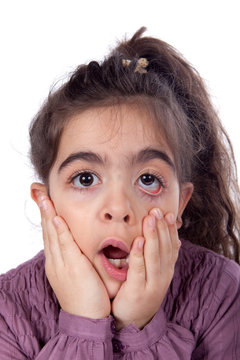 Fillette effray&eacute;e