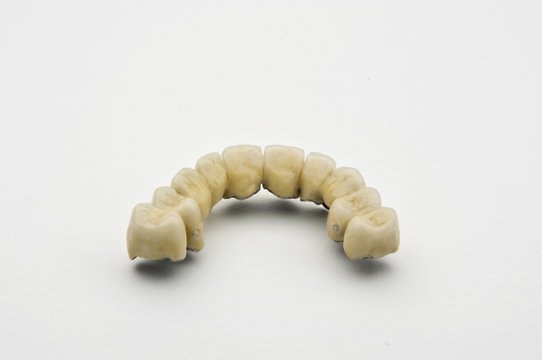 Dental prosthesis