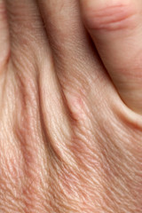 Close-up of human skin on hand