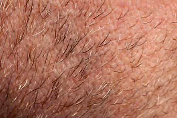 Close-up of human skin and hair on neck