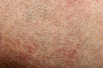 Close-up of human skin