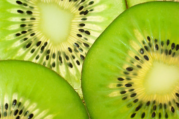 Slices of kiwi fruit (macro)