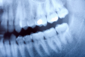 Obraz premium dental x-ray