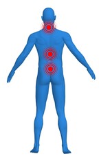 Points of pain