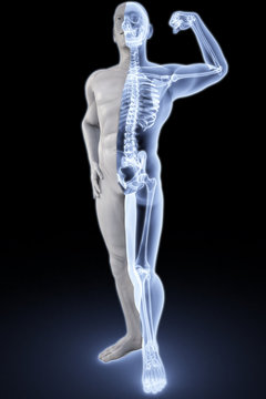 athlete under Xrays