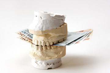 Kosten für Zahnersatz