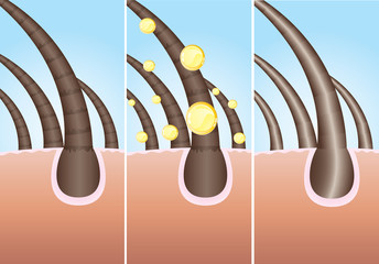Illustration of three phase of hair cure, vector