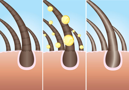 Illustration of three phase of hair cure, vector