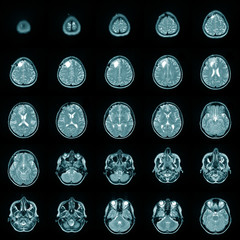 Magnetic risonance image MRI of a human brain