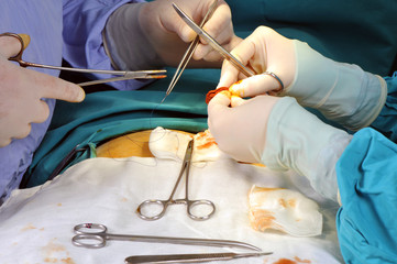 Closeup of a surgeon team performing an operation.