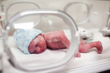Newborn baby covered in vertix in incubator - obrazy, fototapety, plakaty