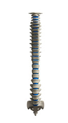 Human spine with spinal plates isolated front view