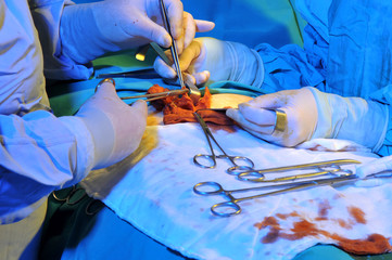 Medical team performing an operation - SURGERY IMAGES