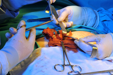 Medical team performing an operation - SURGERY IMAGES