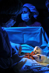 Medical team performing an operation - SURGERY IMAGES