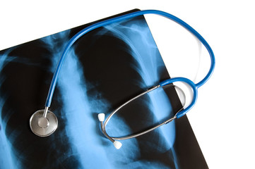 X-ray of lungs and stethoscope