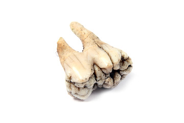 tooth bone