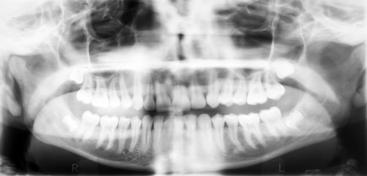 X-ray of the oral cavity.