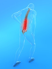 Rückenschmerz - Illustration