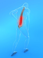 Obraz premium Rückenschmerz - Illustration