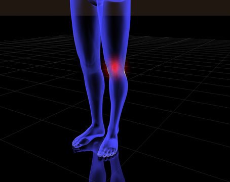 pain en rodilla