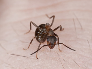 Angry ant biting hair on human hand.