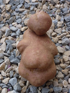 foetus1