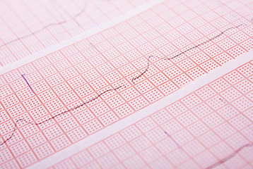 The cardiogram