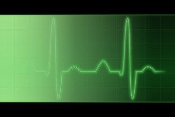 EKG V