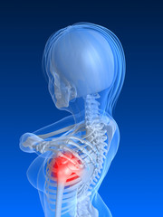 rot markiertes Schultergelenk